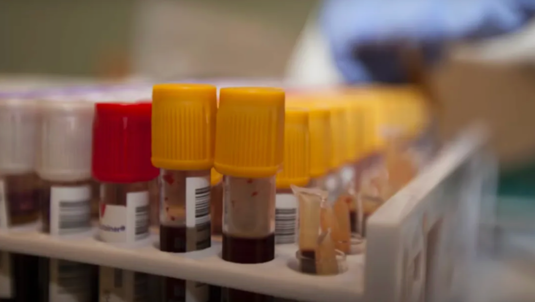 图片[5]-超一亿人处于“新的艾滋病”危险之中-医路上