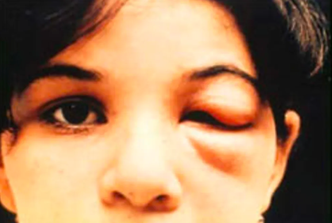 图片[2]-超一亿人处于“新的艾滋病”危险之中-医路上