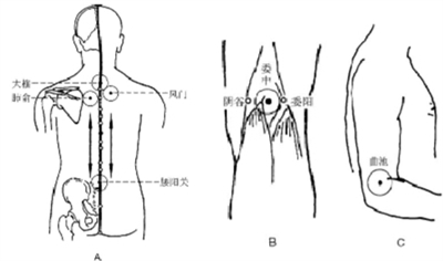 感冒的针灸拔罐疗法-医路上