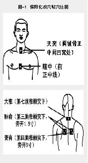温阳化痰穴贴可防治呼吸道疾病-医路上