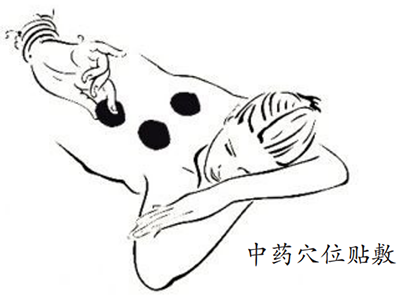 哮喘发作惹人“恼”,中医内外皆有“招”-医路上